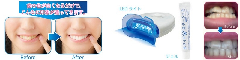 �z���C�gW�X�^�[�k�d�c���C�g�g�p�z�[���z���C�g�j���O���T�C�g